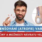 Zmenšování varlat (atrofie varlat): Proč se varlata scvrkávají a jak。